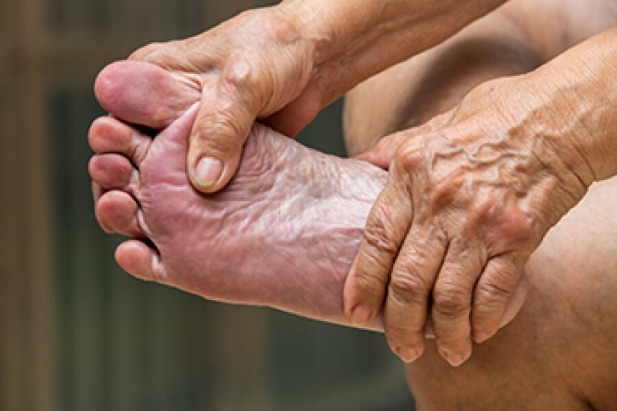 understanding-the-causes-of-purple-feet-in-elderly-individuals